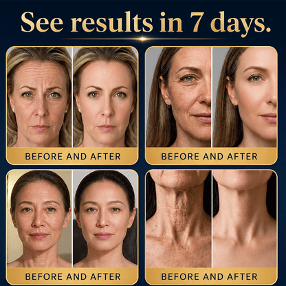 🔥🦘New & Upgraded: Solaroza® 360° Ice-Cool Roller — Visibly reduces dark circles, puffiness, and fine lines in 7 days. Powered by Matrixyl 3000, Neuro-peptides, and Caffeine.