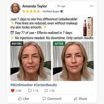 🔥🦘New & Upgraded: Solaroza® 360° Ice-Cool Roller — Visibly reduces dark circles, puffiness, and fine lines in 7 days. Powered by Matrixyl 3000, Neuro-peptides, and Caffeine.